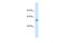 Potassium Voltage-Gated Channel Subfamily A Member Regulatory Beta Subunit 1 antibody, PA5-41019, Invitrogen Antibodies, Western Blot image 