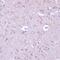 cAMP-dependent protein kinase catalytic subunit beta antibody, GTX54564, GeneTex, Immunohistochemistry paraffin image 