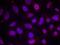Myocyte Enhancer Factor 2A antibody, PA5-37642, Invitrogen Antibodies, Immunofluorescence image 