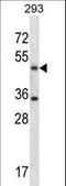 Serine hydroxymethyltransferase, cytosolic antibody, LS-C161077, Lifespan Biosciences, Western Blot image 