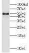 Oxysterol Binding Protein Like 2 antibody, FNab06020, FineTest, Western Blot image 