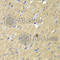 Aldo-Keto Reductase Family 7 Member A2 antibody, A1227, ABclonal Technology, Immunohistochemistry paraffin image 