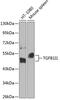 Transforming growth factor beta-1-induced transcript 1 protein antibody, GTX64707, GeneTex, Western Blot image 