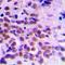 Cyclin Dependent Kinase 1 antibody, orb213697, Biorbyt, Immunohistochemistry paraffin image 