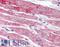 Neuronal Pentraxin 2 antibody, LS-B2694, Lifespan Biosciences, Immunohistochemistry paraffin image 