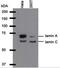Lamin A/C antibody, NBP2-59933, Novus Biologicals, Western Blot image 
