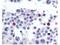 SPANX Family Member C antibody, A14601, Boster Biological Technology, Immunohistochemistry frozen image 
