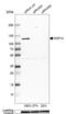 NOP14 Nucleolar Protein antibody, NBP2-13665, Novus Biologicals, Western Blot image 