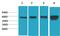 Protein Kinase AMP-Activated Catalytic Subunit Alpha 1 antibody, GTX34141, GeneTex, Western Blot image 