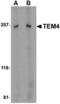 Rho Guanine Nucleotide Exchange Factor 17 antibody, TA306487, Origene, Western Blot image 