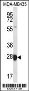RAB27B, Member RAS Oncogene Family antibody, 56-620, ProSci, Western Blot image 