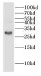Dehydrogenase/Reductase 3 antibody, FNab02372, FineTest, Western Blot image 
