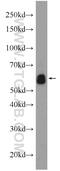 Eukaryotic Translation Initiation Factor 3 Subunit D antibody, 10219-1-AP, Proteintech Group, Western Blot image 