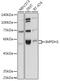 Inosine Monophosphate Dehydrogenase 1 antibody, GTX66572, GeneTex, Western Blot image 