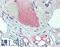 Vascular Endothelial Growth Factor B antibody, LS-B15549, Lifespan Biosciences, Immunohistochemistry paraffin image 