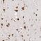 Brain Enriched Guanylate Kinase Associated antibody, NBP1-82907, Novus Biologicals, Immunohistochemistry frozen image 