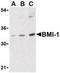 BMI1 Proto-Oncogene, Polycomb Ring Finger antibody, LS-C19577, Lifespan Biosciences, Western Blot image 