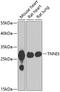 Troponin I3, Cardiac Type antibody, 22-617, ProSci, Western Blot image 