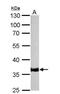 Tropomyosin 1 antibody, NBP1-33716, Novus Biologicals, Western Blot image 