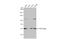 Chaperonin Containing TCP1 Subunit 2 antibody, GTX112283, GeneTex, Western Blot image 