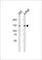 GLI Family Zinc Finger 2 antibody, LS-C344252, Lifespan Biosciences, Western Blot image 