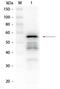 Aldehyde dehydrogenase [NAD(P)+] 1 antibody, GTX48856, GeneTex, Western Blot image 