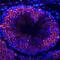 Heat Shock Transcription Factor 1 antibody, MA5-24354, Invitrogen Antibodies, Immunohistochemistry paraffin image 