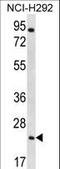 Aquaporin 5 antibody, LS-C156444, Lifespan Biosciences, Western Blot image 