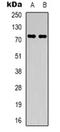 Pre-MRNA Processing Factor 39 antibody, orb318825, Biorbyt, Western Blot image 