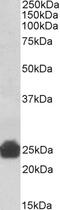 Cytochrome B5 Reductase 3 antibody, 42-440, ProSci, Western Blot image 