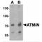 ATM Interactor antibody, MBS153392, MyBioSource, Western Blot image 