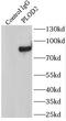 Procollagen-Lysine,2-Oxoglutarate 5-Dioxygenase 2 antibody, FNab06552, FineTest, Immunoprecipitation image 