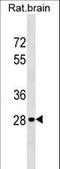 Homeobox D9 antibody, LS-C158817, Lifespan Biosciences, Western Blot image 