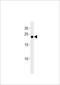 Interferon Alpha 4 antibody, A08980-1, Boster Biological Technology, Western Blot image 