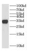 Dehydrogenase/Reductase 4 antibody, FNab02373, FineTest, Western Blot image 