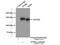 Adaptor Related Protein Complex 3 Subunit Beta 2 antibody, 18331-1-AP, Proteintech Group, Immunoprecipitation image 