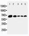 Paxillin antibody, PA1804, Boster Biological Technology, Western Blot image 