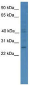 GTP Cyclohydrolase 1 antibody, TA342673, Origene, Western Blot image 