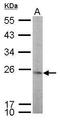 TATA-Box Binding Protein Like 1 antibody, GTX104694, GeneTex, Western Blot image 
