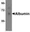 Albumin antibody, NBP1-77027, Novus Biologicals, Western Blot image 