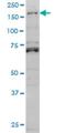 Lemur Tyrosine Kinase 3 antibody, H00114783-M02, Novus Biologicals, Western Blot image 