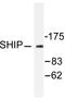 Inositol Polyphosphate-5-Phosphatase D antibody, LS-C176205, Lifespan Biosciences, Western Blot image 