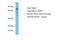 Glycerol-3-Phosphate Acyltransferase 2, Mitochondrial antibody, ARP49213_P050, Aviva Systems Biology, Western Blot image 