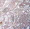 NFKB Inhibitor Beta antibody, AP0262, ABclonal Technology, Immunohistochemistry paraffin image 