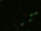 Bone Morphogenetic Protein 4 antibody, GTX84821, GeneTex, Immunofluorescence image 