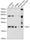 Glutathione Peroxidase 7 antibody, GTX65626, GeneTex, Western Blot image 