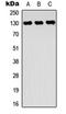 Receptor Tyrosine Kinase Like Orphan Receptor 2 antibody, orb304558, Biorbyt, Western Blot image 