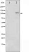 Protein Kinase D1 antibody, GTX52343, GeneTex, Western Blot image 