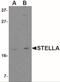 Developmental Pluripotency Associated 3 antibody, NBP2-41089, Novus Biologicals, Western Blot image 