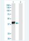 Heterogeneous nuclear ribonucleoproteins C1/C2 antibody, H00003183-M02-100ug, Novus Biologicals, Western Blot image 